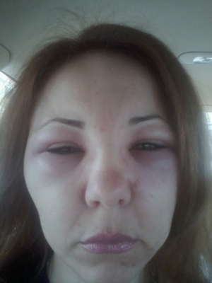 Avocata a ramas cu fata paralizata (foto:rtv.net)