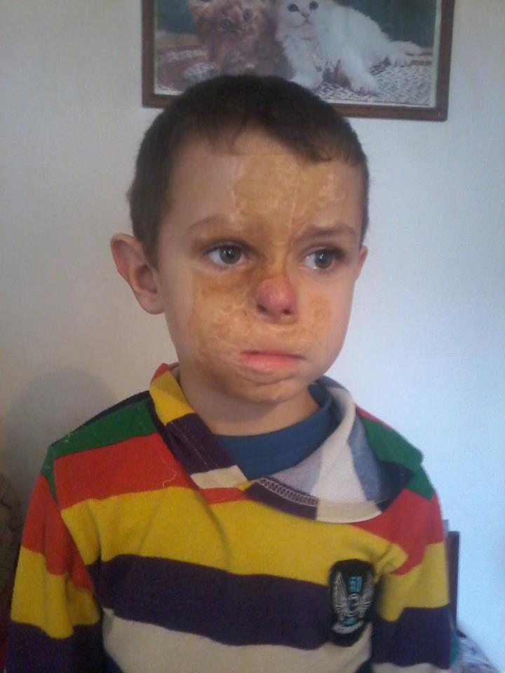 Lui Paul i-a cazut un resou in fata la varsta de 11 luni