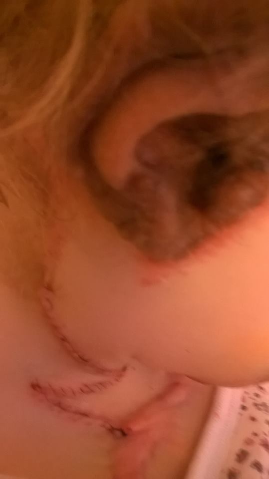 Teo s-a nascut cu o boala grava de piele