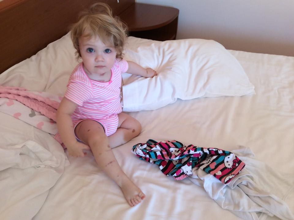 Teo mai are nevoie de tratamente pentru a fi vindecata complet