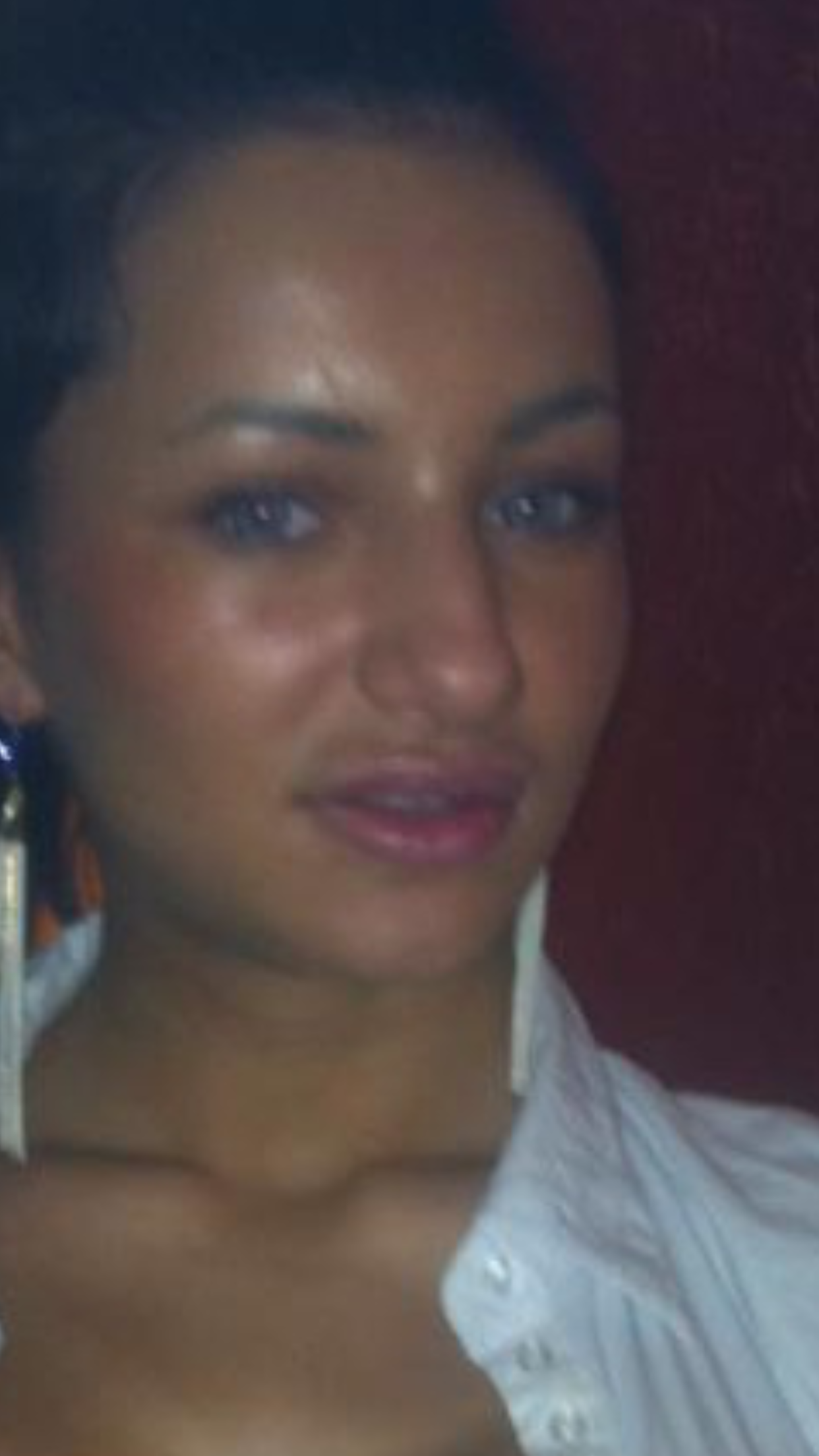 Asa arata Larisa inainte sa se opereze