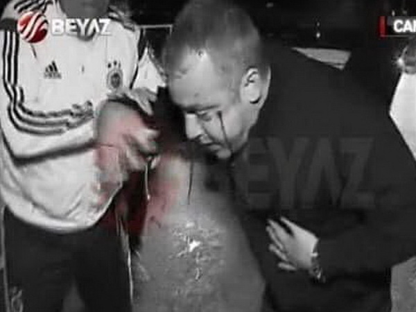 AC atac armat turcia