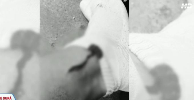 Augustin Viziru are o tija la picior