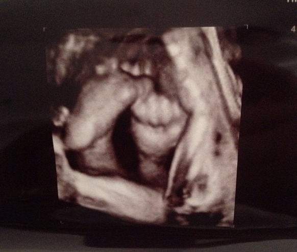 Aylin a postat ecografia pe pagina ei de socializare