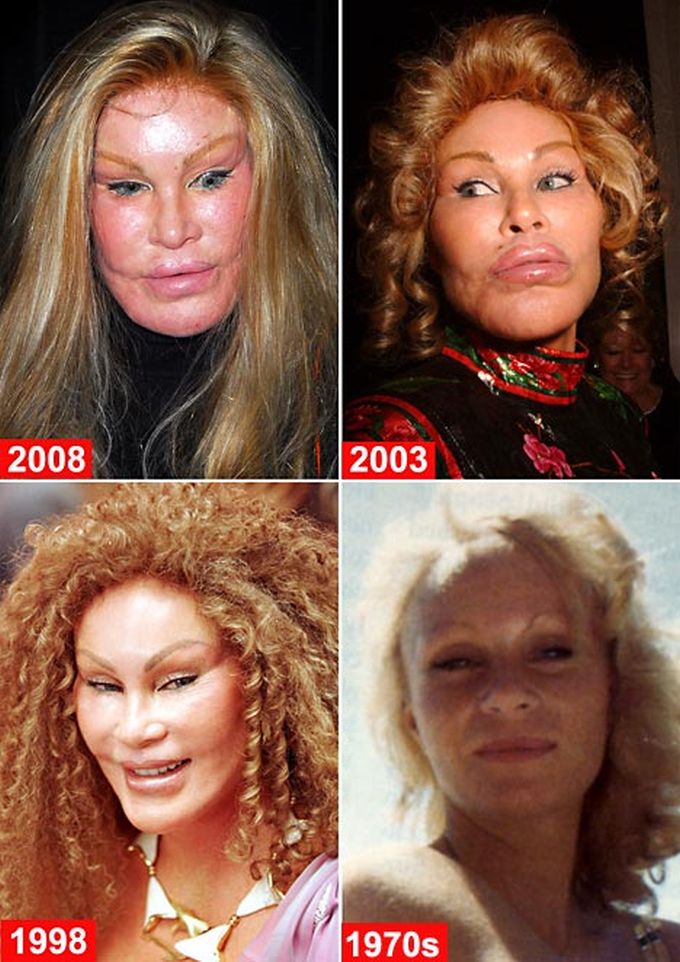 Jocelyn Wildenstein