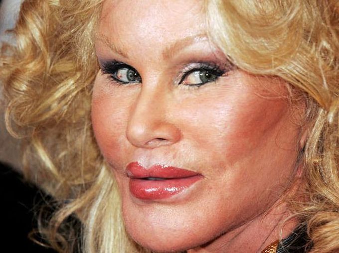 Jocelyn Wildenstein