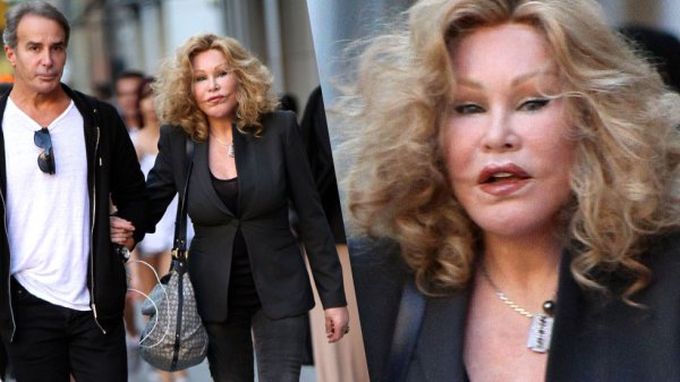 Jocelyn Wildenstein