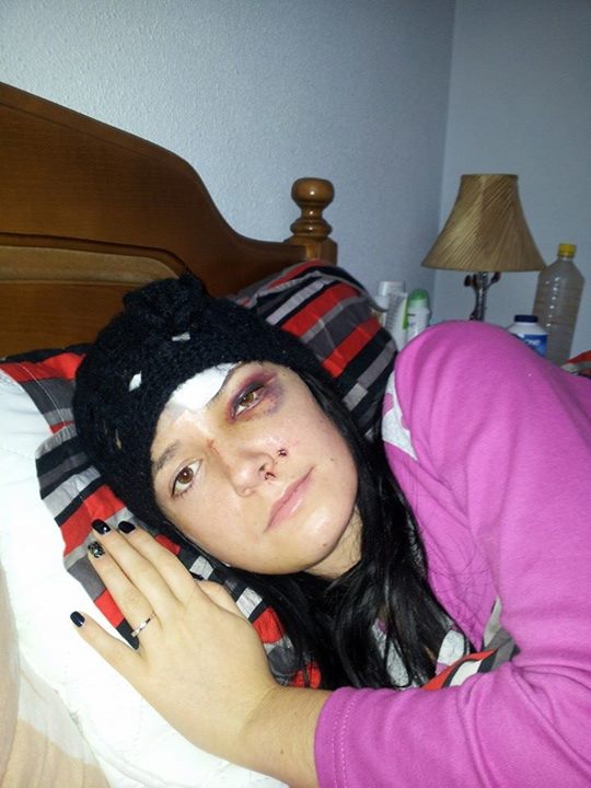 O artista din Iasi a mancat timp de sase saptamani cu paiul din cauza loviturilor crunte pe care le-a luat.