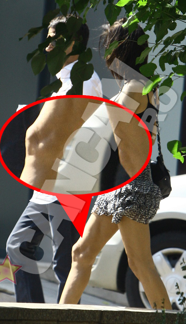 Picioarele Oanei Zavoranu arata foarte urat