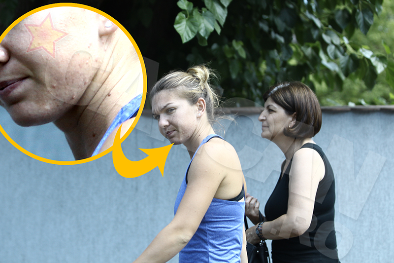 Fata Simonei Halep este plina de cosuri