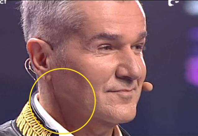 Bittman a fost operat la gat