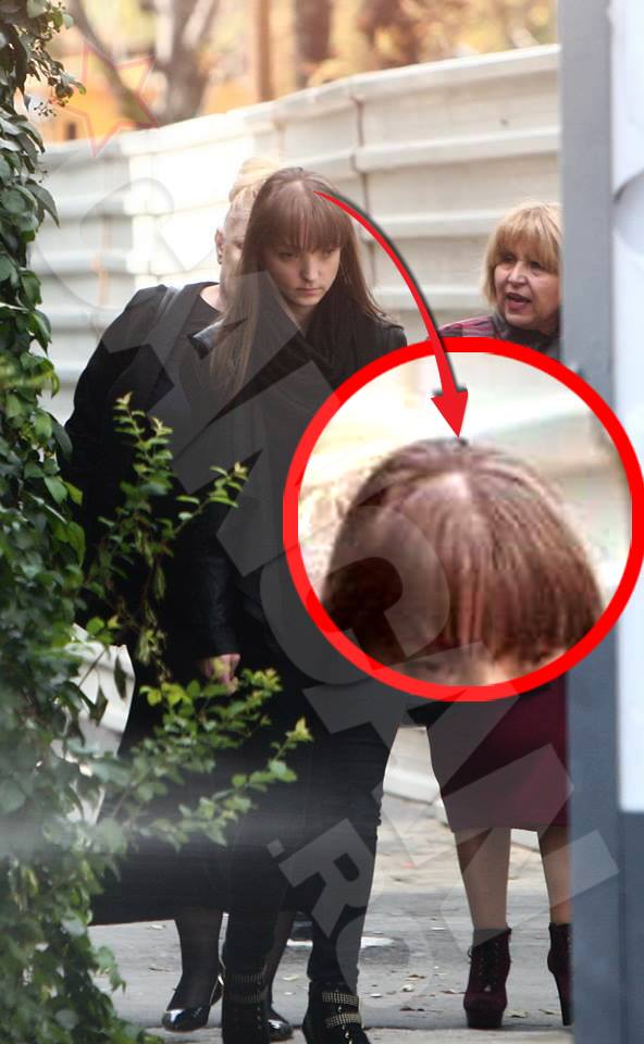 Fiica cea mare a lui Vadim Tudor sufera de o forma severa de alopecie