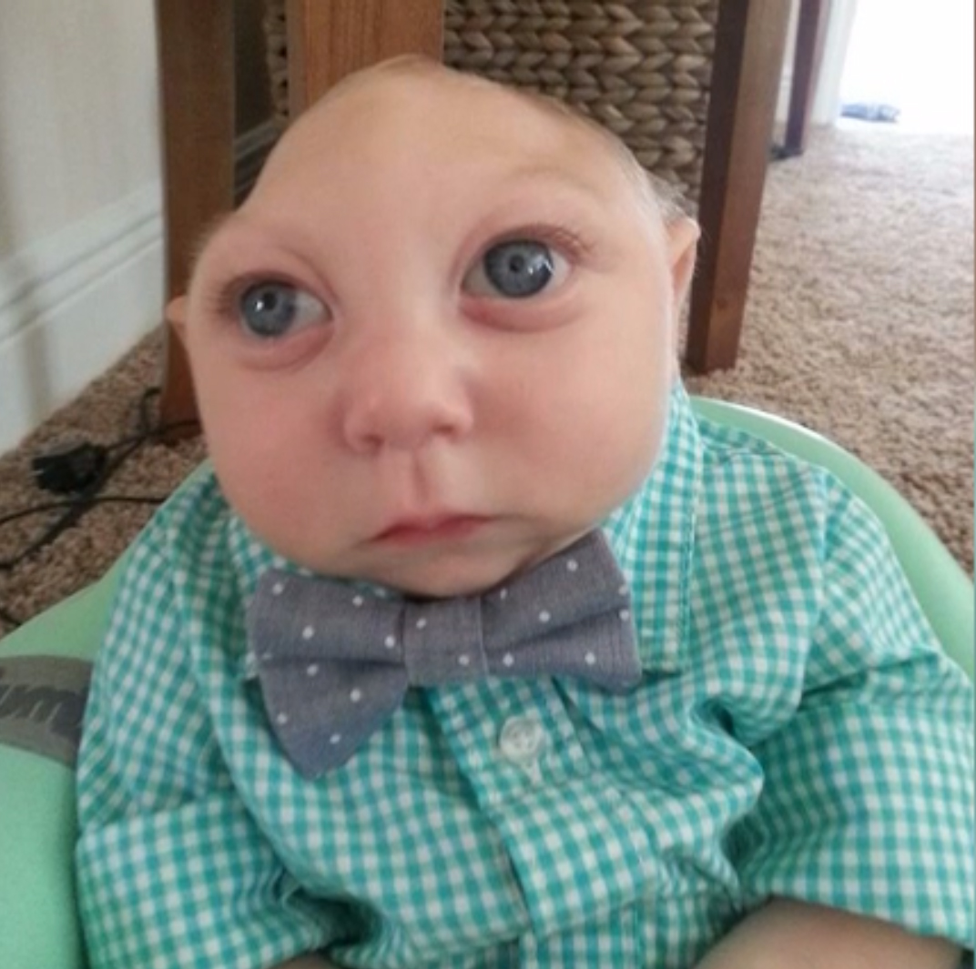 copil jumatate de cap