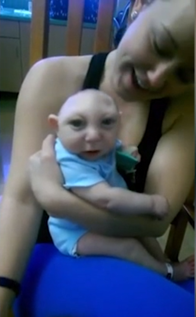 copil jumatate de cap