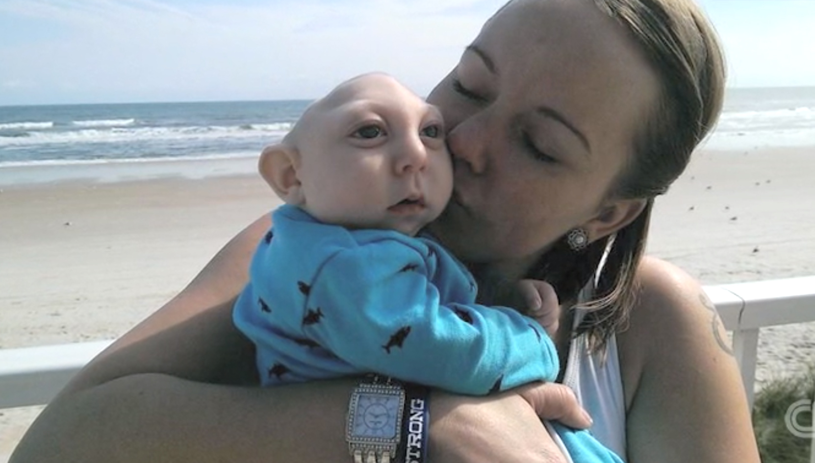 copil jumatate de cap