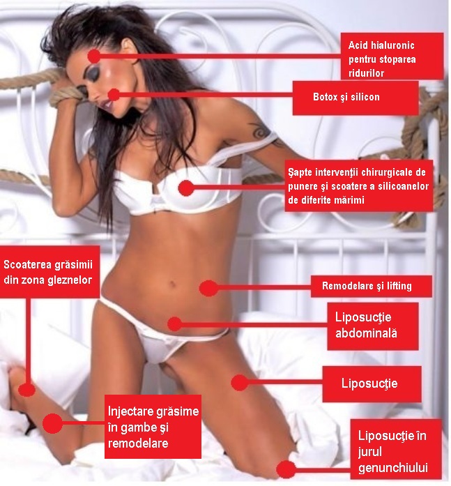 Oana Zavoranu este o femeie frumoasa, insa tot a simtit nevoia unor 