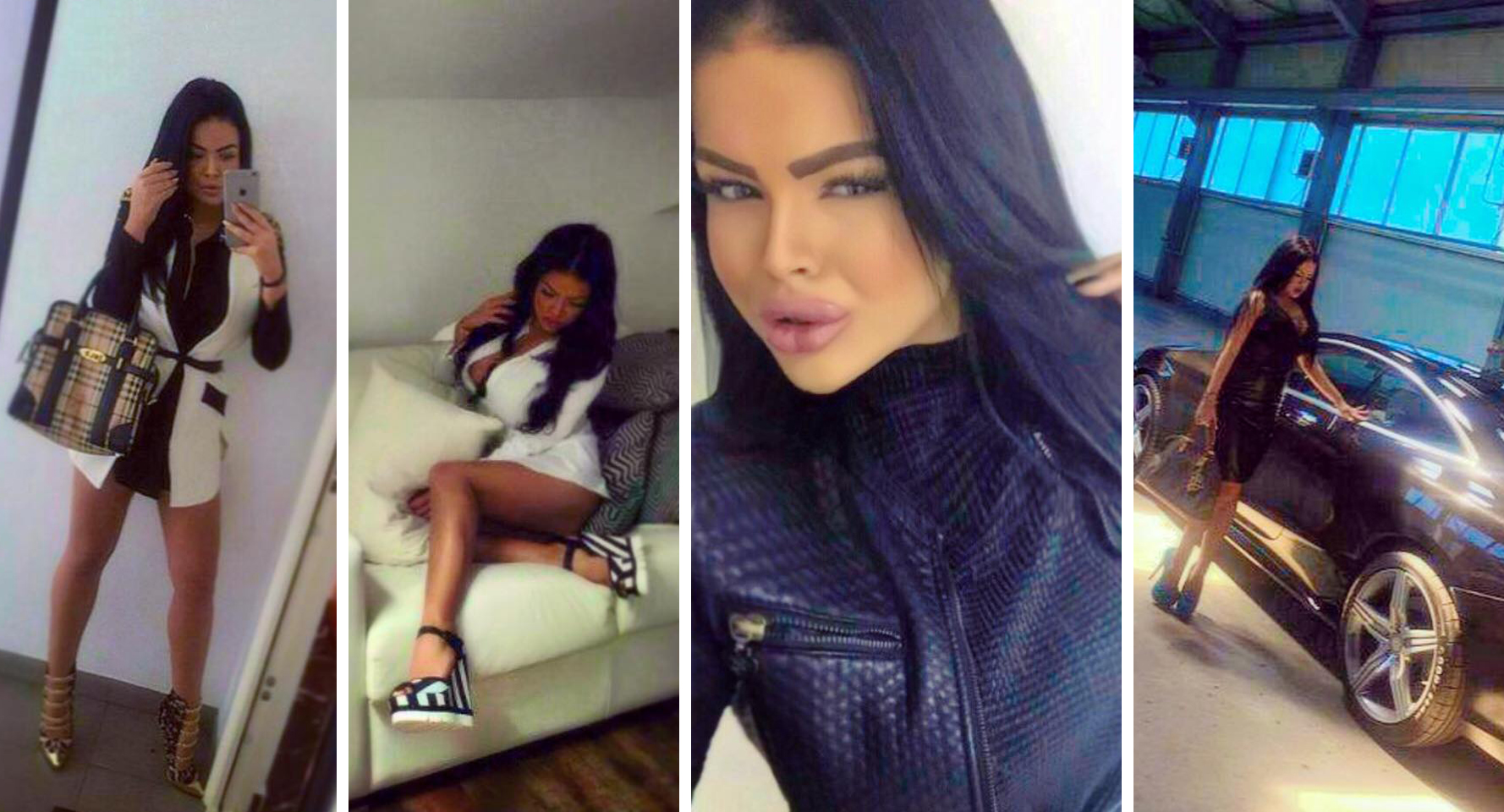 Si Bianca a apelat la doctorii esteticieni