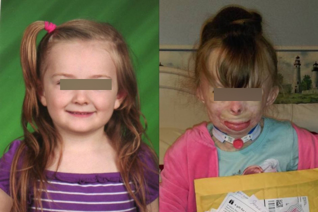 Safyre Terry a fost mutilata de flacari