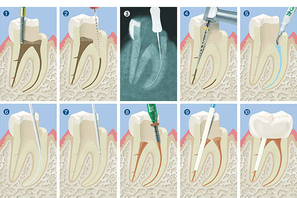 Asa arata procedurile stomatologice standard