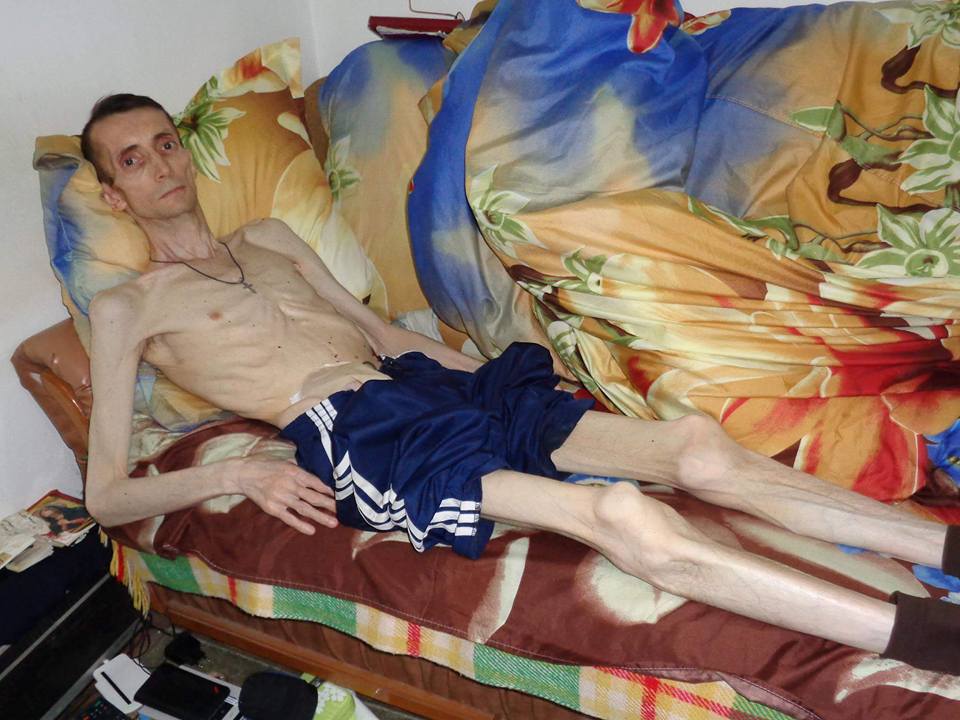 Starea de sanatate a lui Eugen Movila nu este una deloc buna