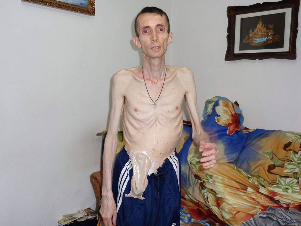 Barbatul este foarte slab