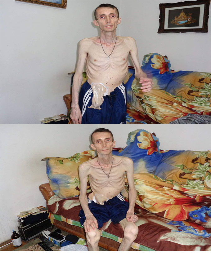 Are 47 de ani si cantareste cat un pusti de sapte ani