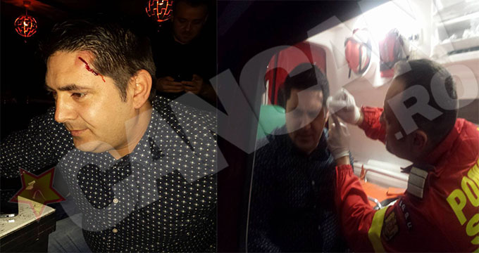 Szekely susţine că primarul i-a dat cu scaunul în cap