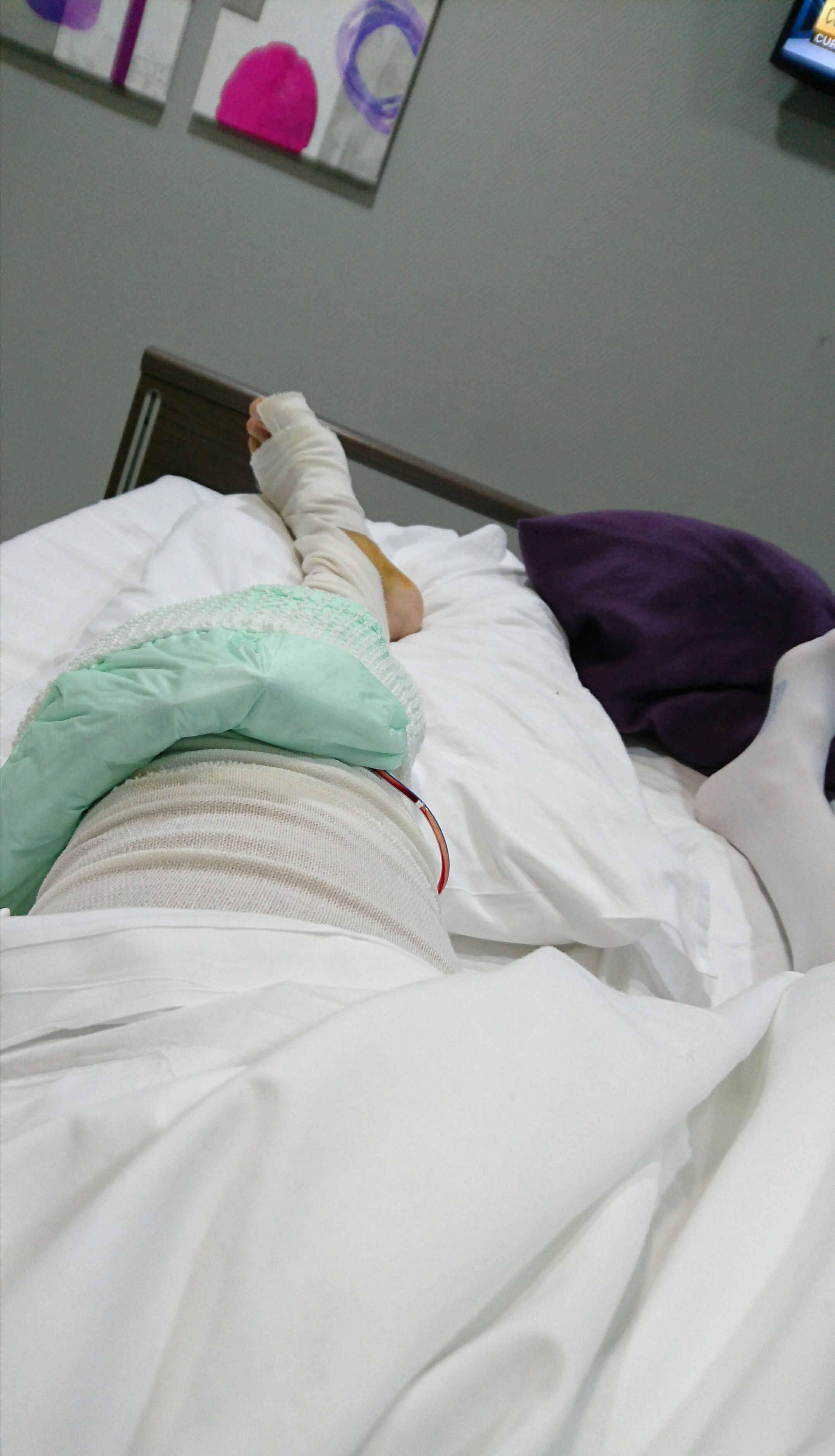 Mircea Badea a suferit o operatie complexă la genunchi
