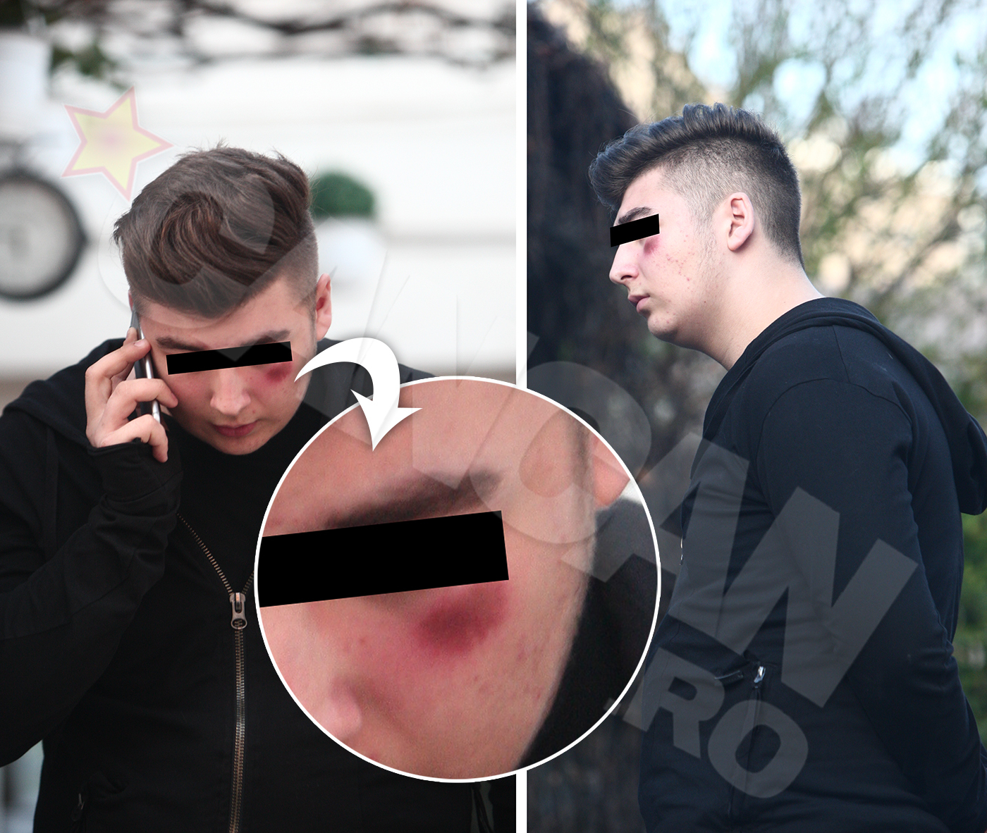 Perversa lui Reghe a lăsat urme pe faţa lui Michael, victimă colaterală în conflictul antrenorului cu ex-ul fiicei sale vitrege. Fundaş dreapta de meserie, Reghecampf a trăit probabil toată viaţa cu complexul că nu prea are ocazia să dea cu capul, aşa că recuperează prin cluburi cât poate.