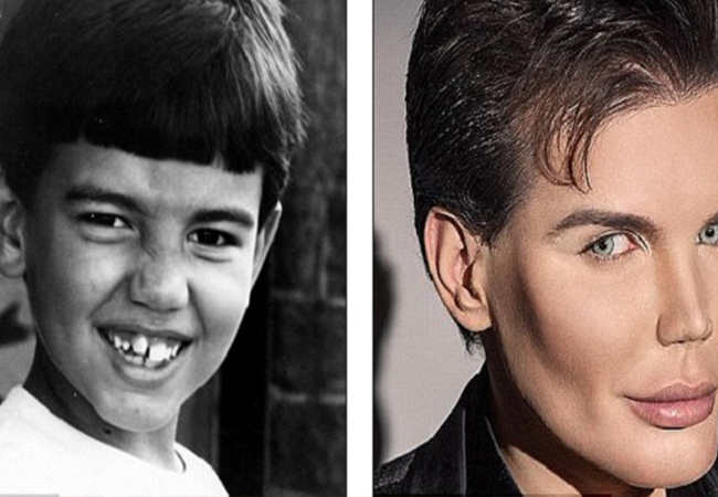 În prima imagine, îl puteţi vedea pe Ken în copilărie, înainte să îşi facă operaţii estetice. În cea de-a doua imagine, îl puteţi vedea pe Ken după cele 42 de operaţii estetice.