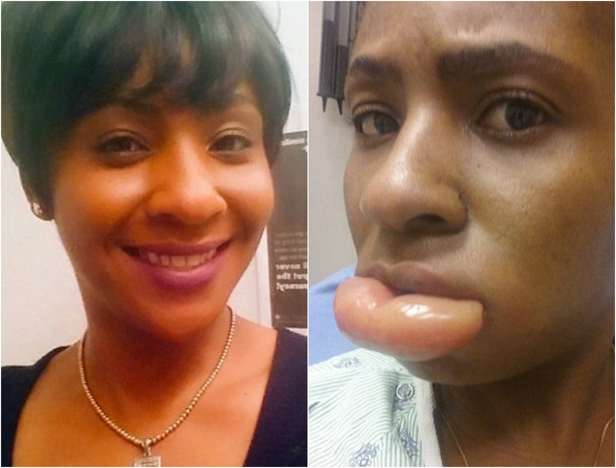 Tânăra de culoare a trecut prin clipe horror din cauza unui banal ruj, iar medicii i-au spus că putea să moară dacă nu vedea la spital