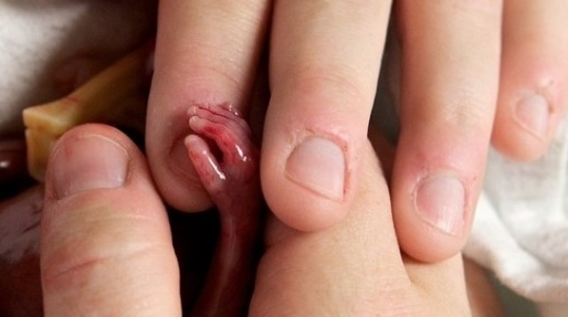 Cel mai mic nou-născut din lume a respirat doar câteva secunde.