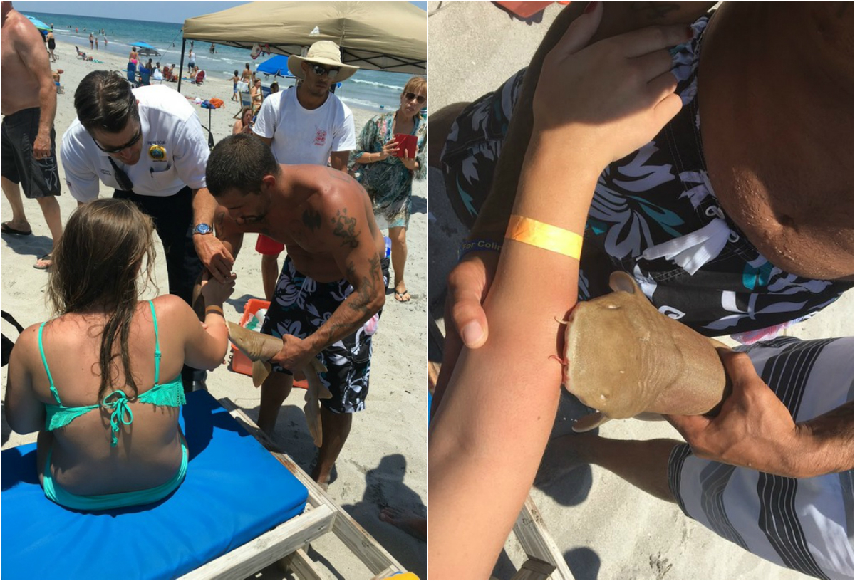 Medicii au reuşit abia la spital să desprindă rechinul de braţul femeii de 23 de ani