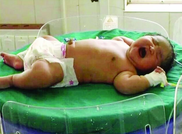 Fetiţa-gigant s-a născut în India