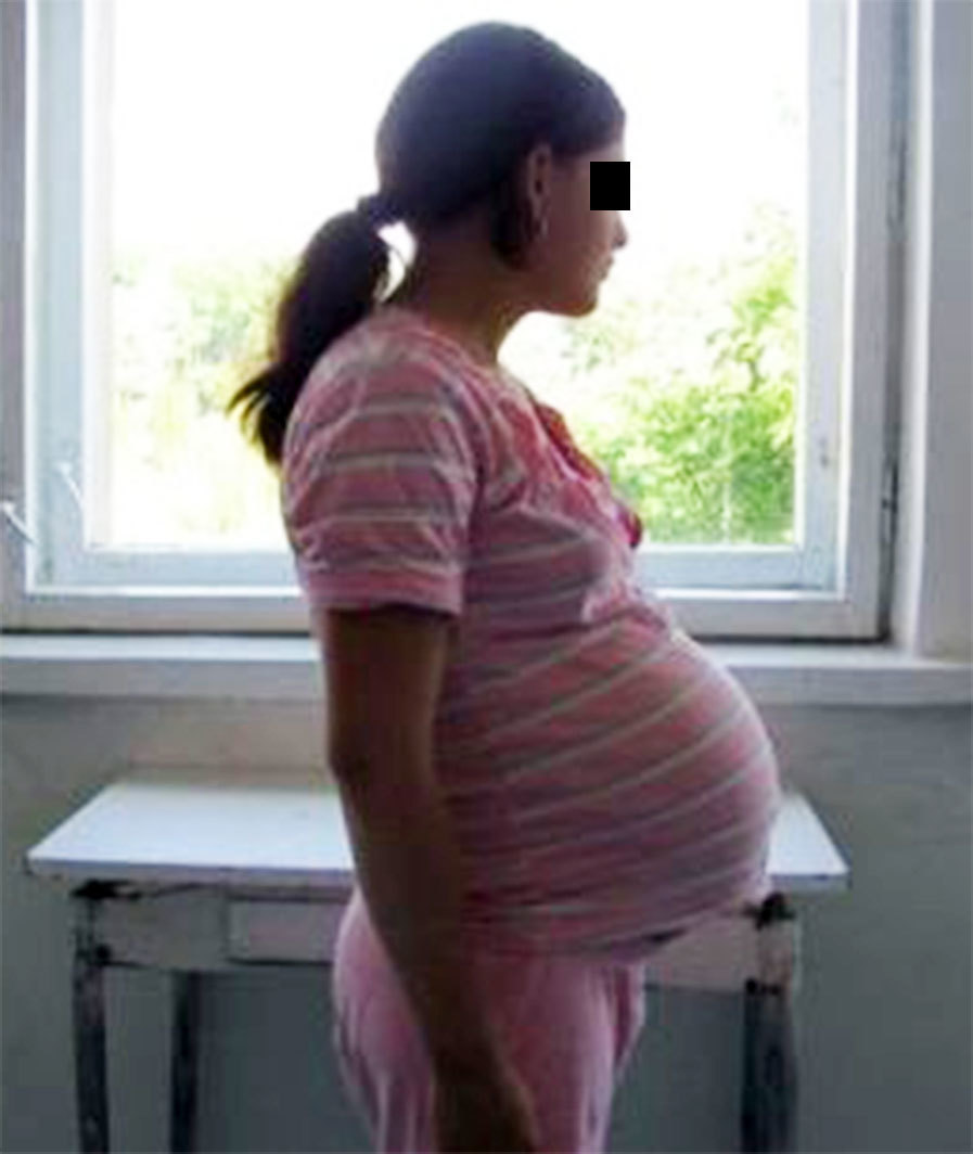 Tânăra de 16 ani a rămas gravidă cu un bărbat de 24 de ani