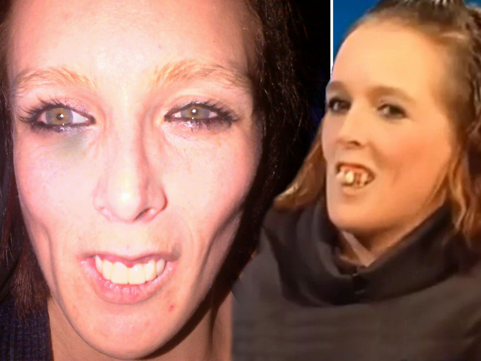 Gemma poate zâmbi acum precum un om perfect normal