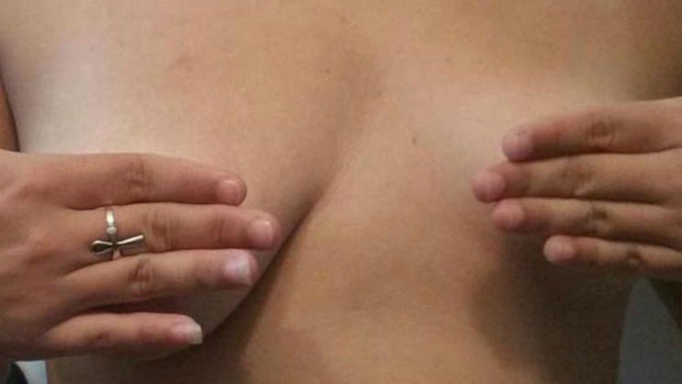 Aşa arătau sânii Dariei înainte de operaţie