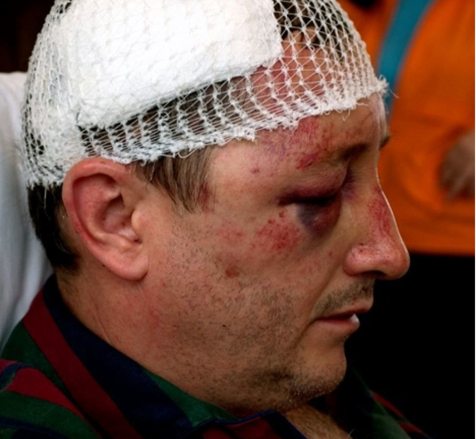 Tofan a scăpat cu viaţă dintr-un atac mafiot dar a rămas cu sechele