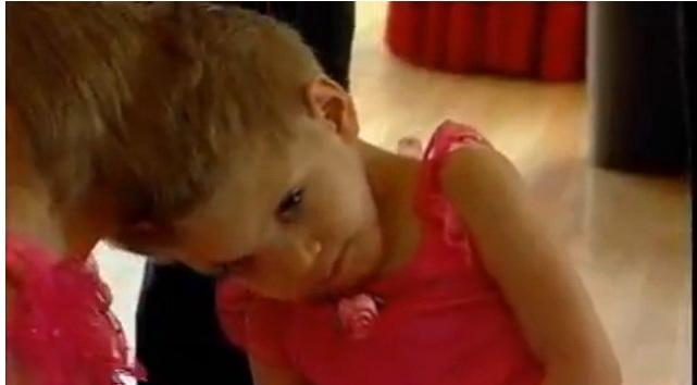 Niciun medic din lume nu a reusit sa le separe pe cele doua fetite