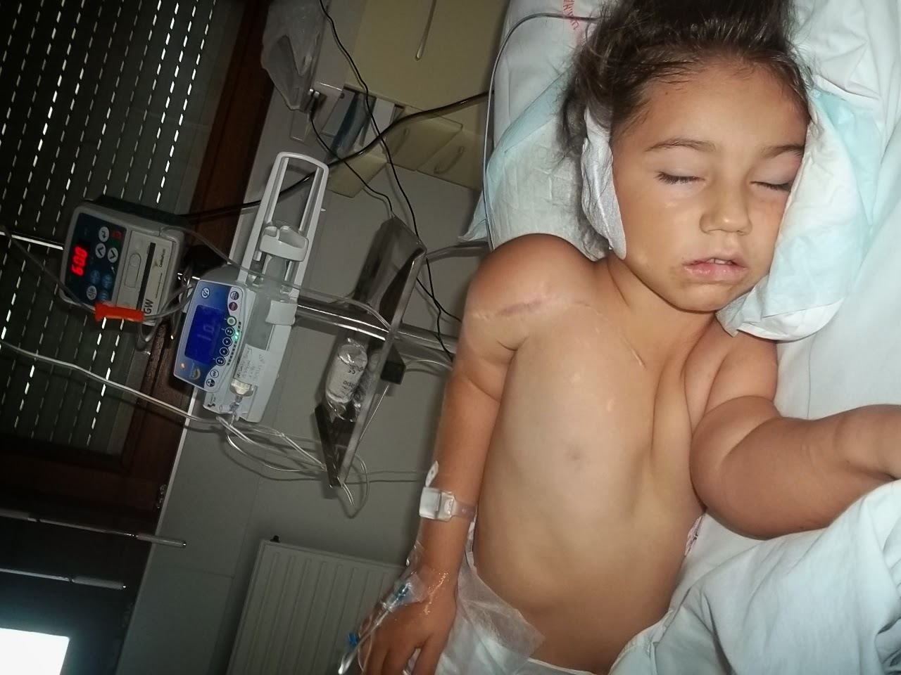 Kassndra, dupa una dintre multele interventii chirurgicale la care a fost supusa