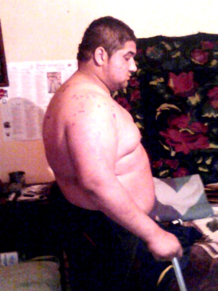 Marius se sprijina de o carja atunci cand sta in picioare