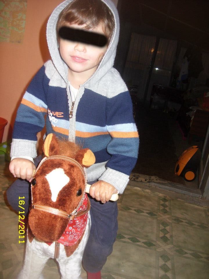 Pe chipul micutului inca se mai vad semne de la incidentul din 2009