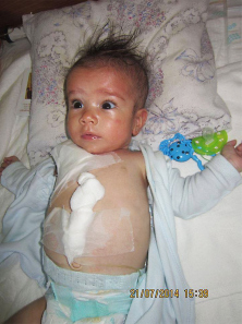 Cel mai rau este cel mic, deoarece a contractat mai multi microbi