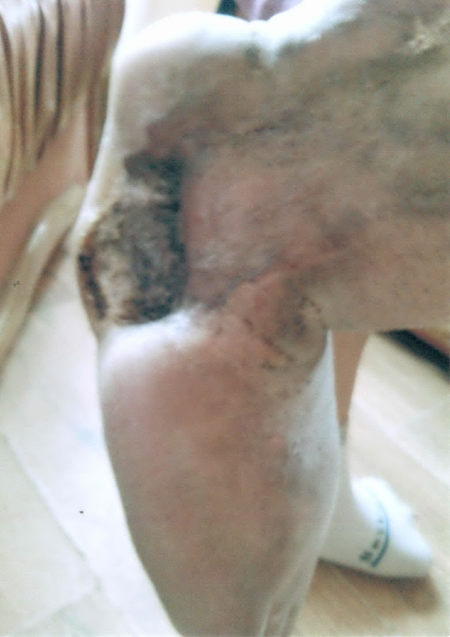 Florin nu isi mai poate folosi piciorul drept