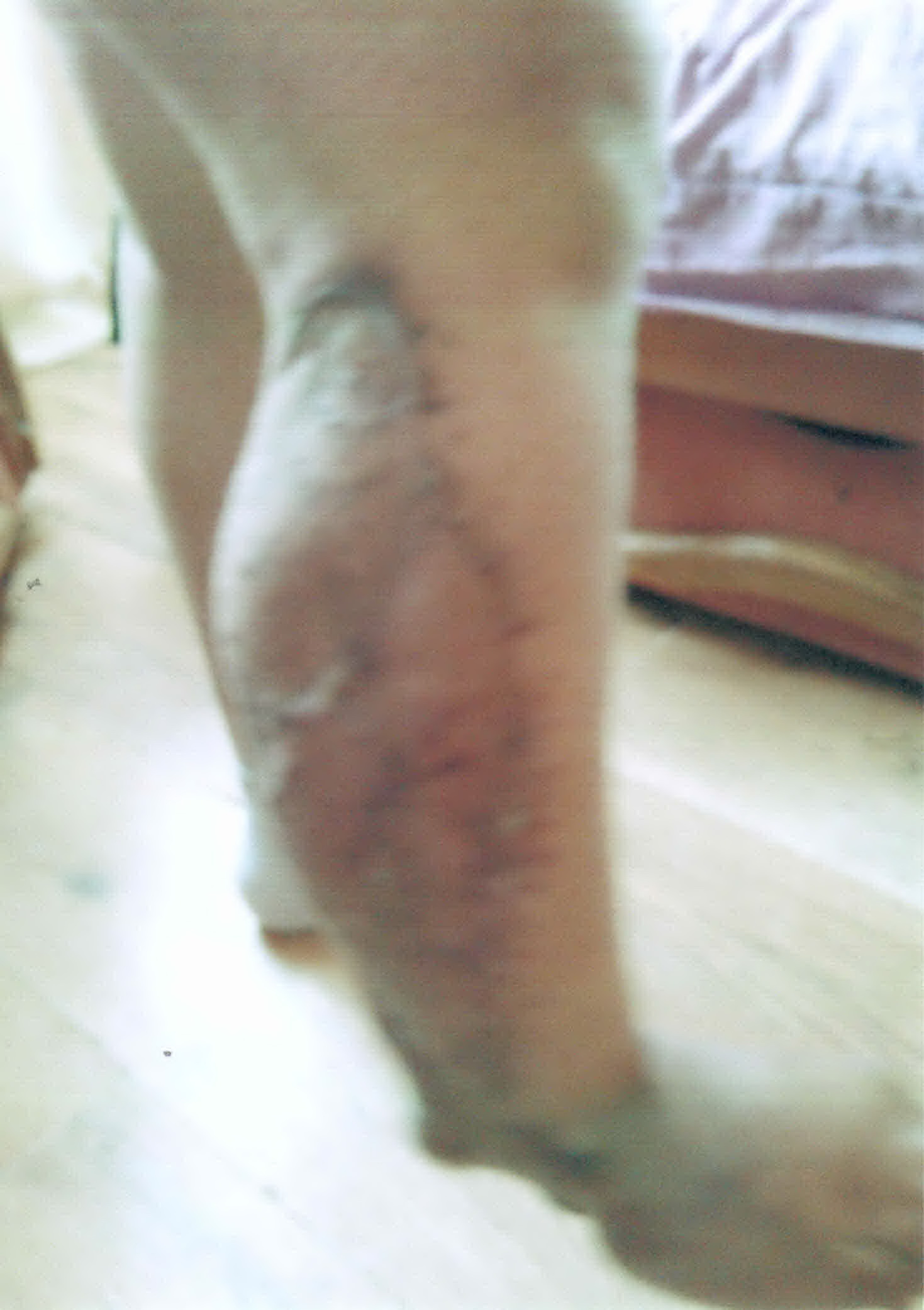 Florin a facut plangere penala impotriva medicului care l-a operat