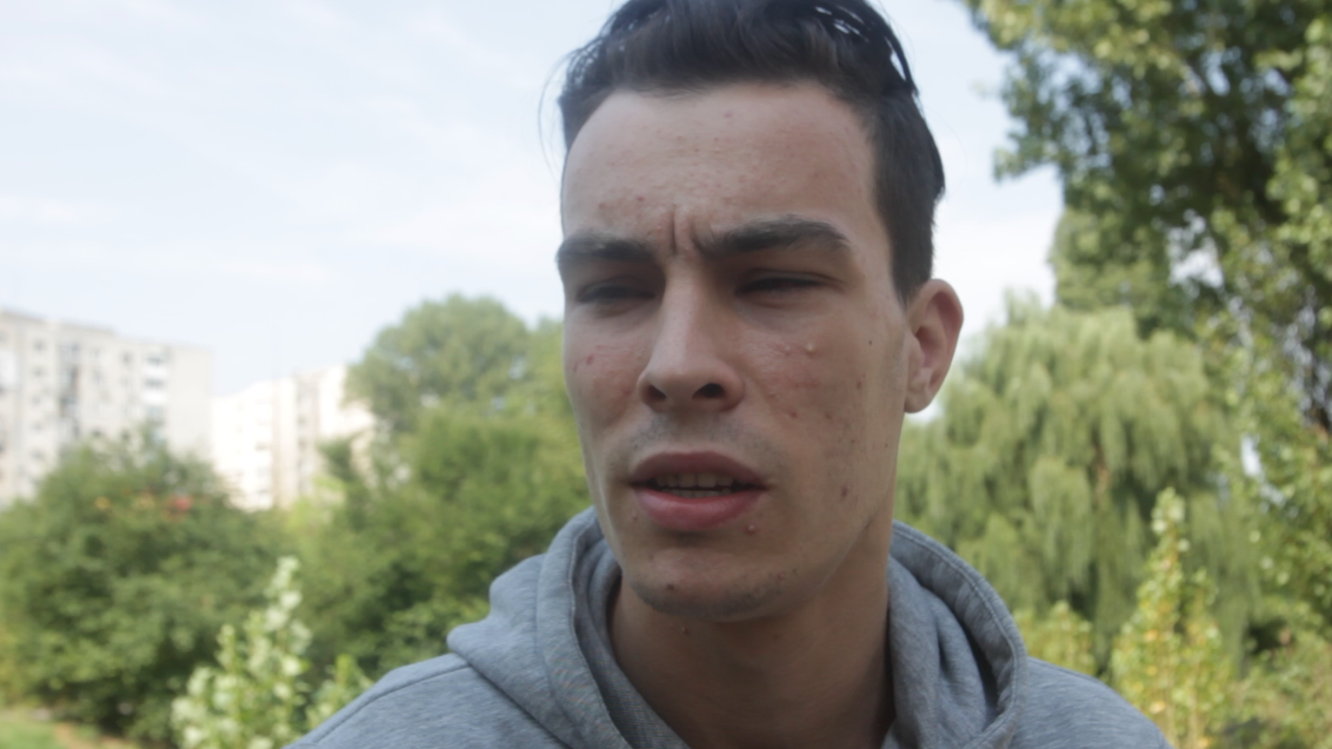 Bogdan a suferit de curand o operatie la ochi