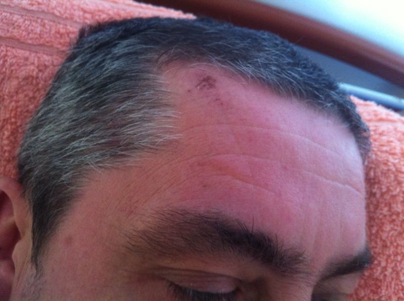 Barbatul s-a ales si cu capul spart