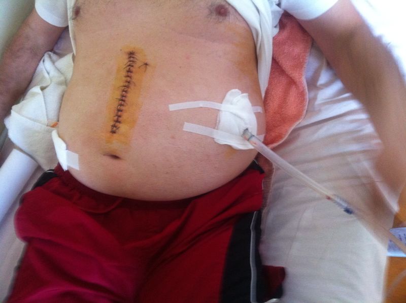 Taximetristul s-a ales cu mai mutle copci pe tot corpul