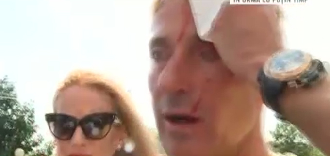 Primarul Constantei s-a lovit atat de rau, incat chipul i-a fost inundat de sange