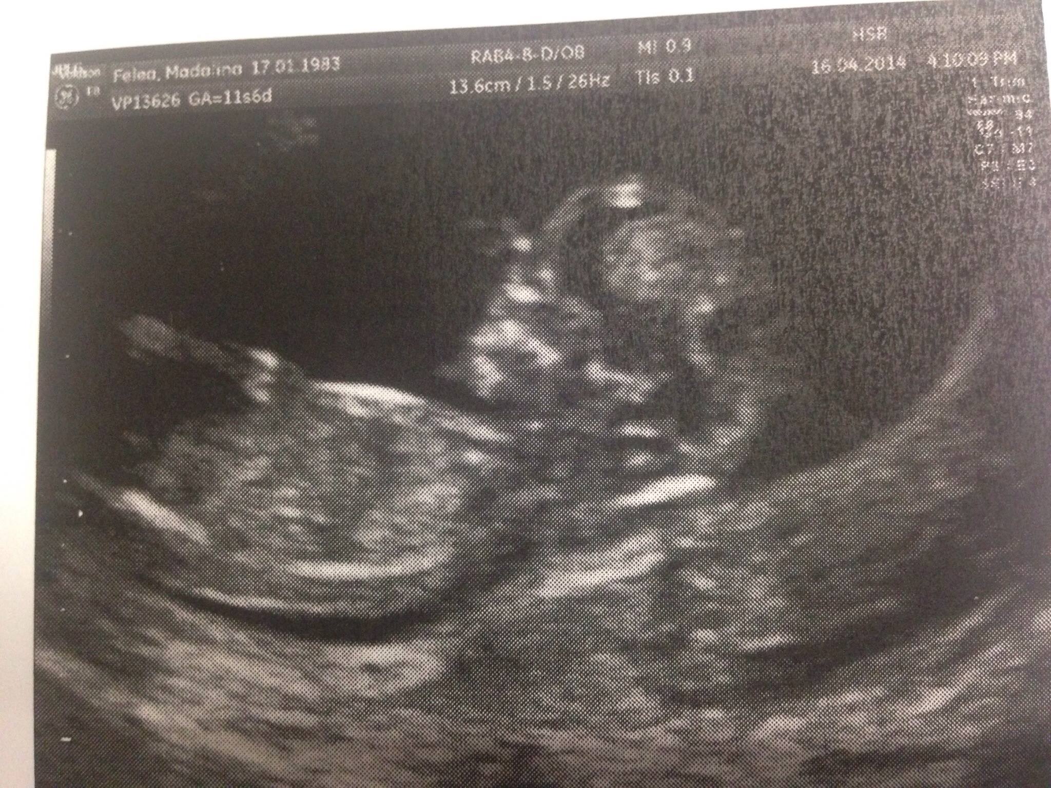 la rpima ecografie medicii i-au spus ca are un baietel